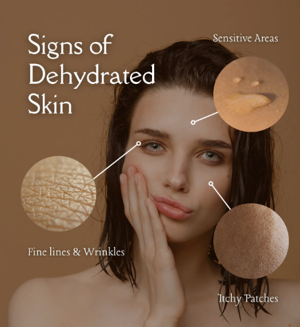 dry skin