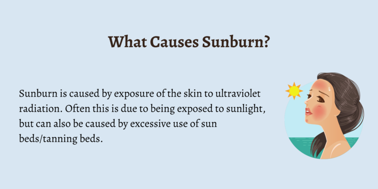 Illustration explaining what causes sunburn, with a depiction of a woman experiencing sunburn under the sun.
