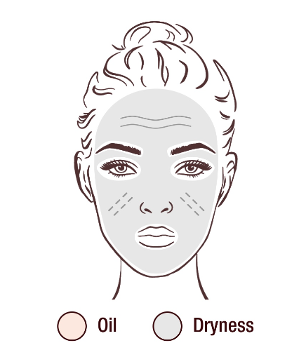 Illustration of a face showing areas prone to oiliness and dryness. The forehead, nose, and chin areas are shaded to indicate oiliness, while the cheeks are marked to indicate dryness.