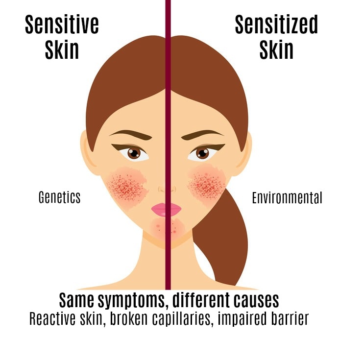 sensitive-skin